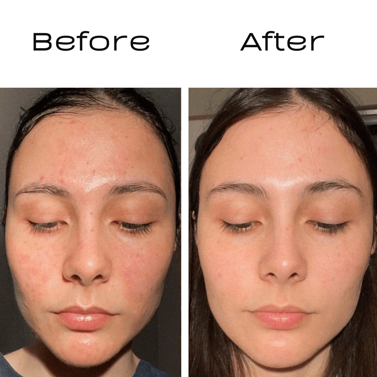 Laura · 6 weeks · Spot Reset Ritual