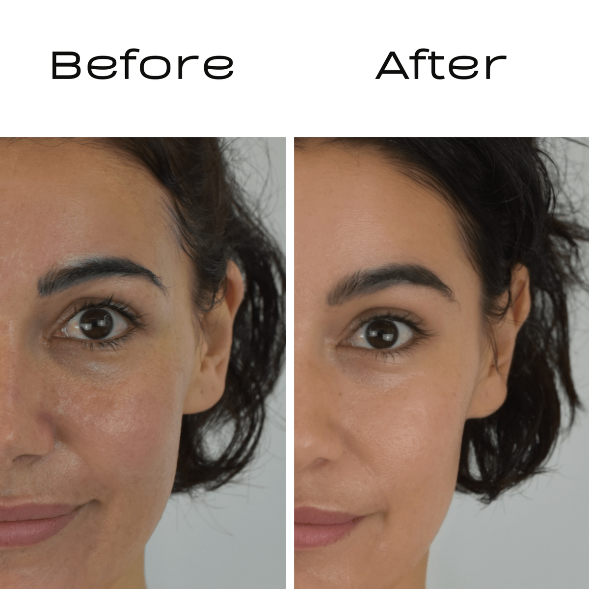 Iulia · 8 weeks · Kojic Drip