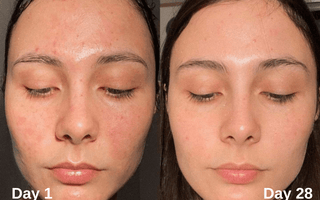 The Ultimate Guide to Radiant Skin: Unlocking the Power of Niacinamide & Kojic Acid Serum